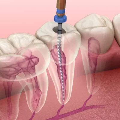 Dr El Khiam Rania dentiste casablanca maroc